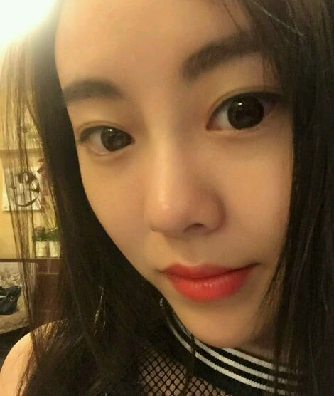 成都美极做双眼皮好不好？有案例吗？