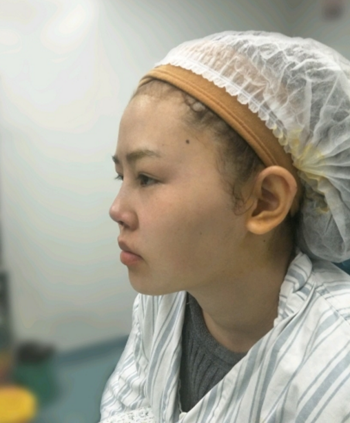 *手术110天了,很美很喜欢的*果