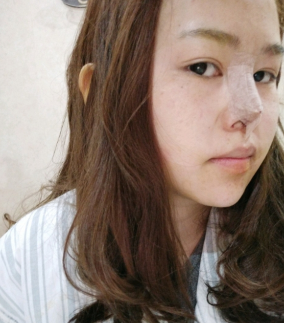 *手术110天了,很美很喜欢的*果