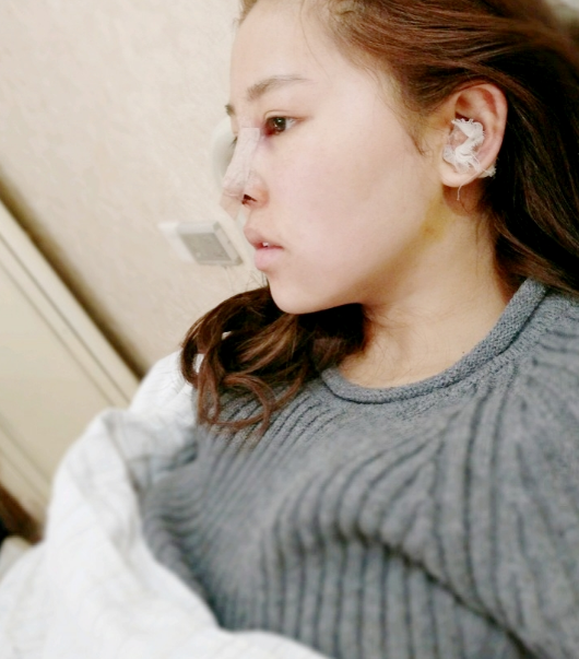 *手术110天了,很美很喜欢的*果