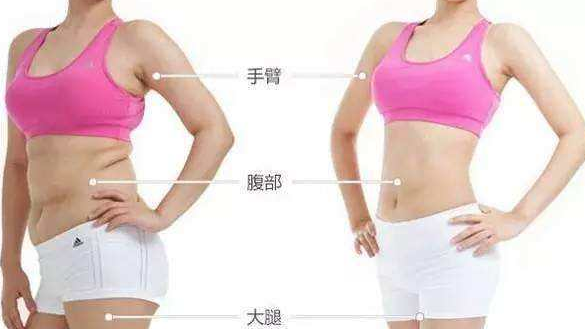 光纤吸脂的*果,好身材瘦下来