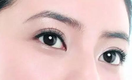 双眼皮手术后恢复慢主要有三个原因