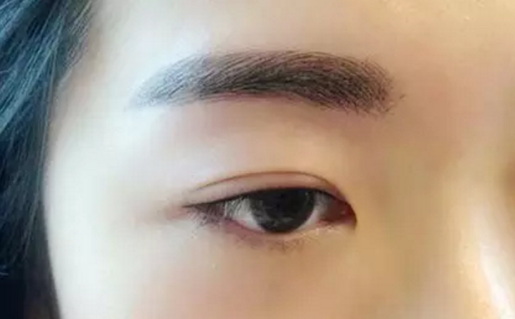 为什么有些人的双眼皮一眼就被人看出是做的?