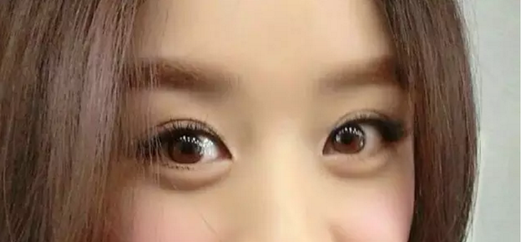 为什么有些人的双眼皮一眼就被人看出是做的?