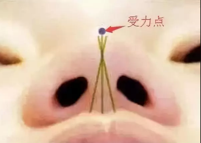 为什么隆鼻医生都不建议做*?