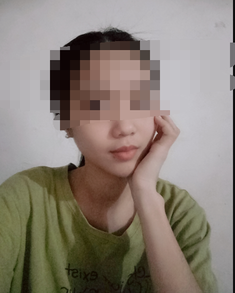 北京八大处张智勇医生做的轮廓三件套,费用七