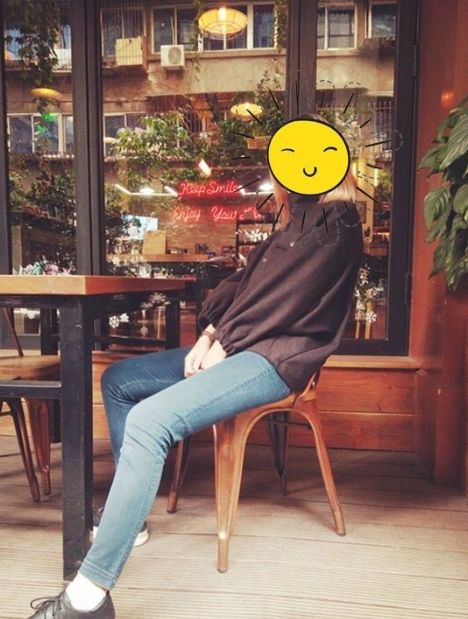 八大处东院齐越医生大腿环吸+臀下线+脂肪填屁股