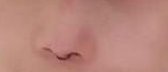 在广州颜美荟于建刚医生那里做的隆*