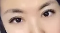 深圳美莱陈磊医生全切➕开眼角价格6800元