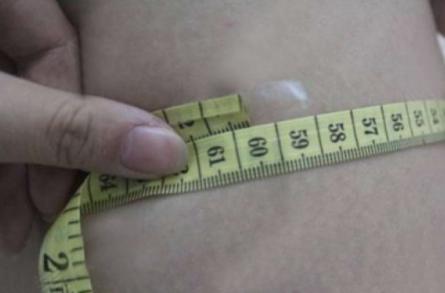 济南吸脂瘦腰腹105天的*果以及济南吸脂好的医
