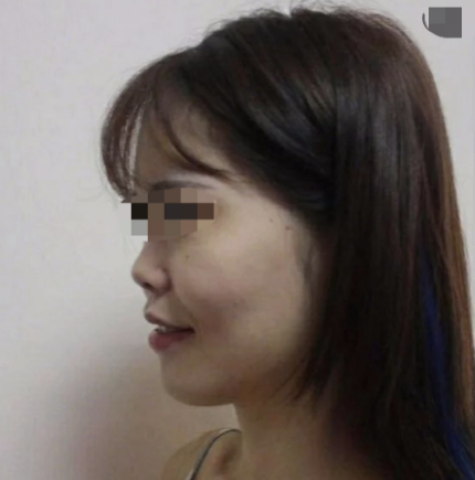 武汉隆鼻比较好的医院医生(部分)
