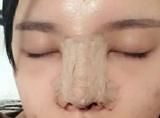 武汉隆鼻比较好的医院医生(部分)