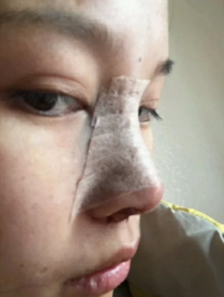 武汉隆鼻比较好的医院医生(部分)