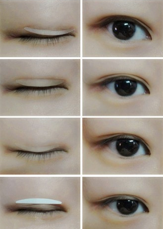 双眼皮贴vs双眼皮手术,你怎么选择?