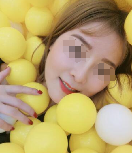 成都贾德渊隆鼻怎么样?隆鼻案例分享