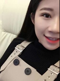 术后69天分享,拯救内双肿泡眼