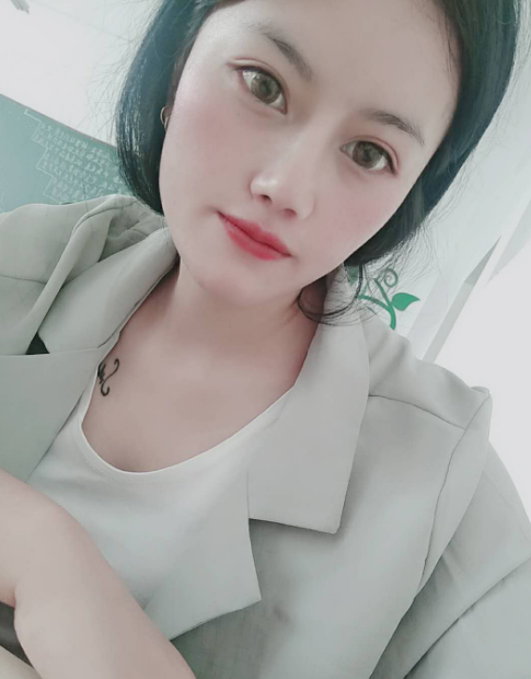 在昆明梦想做的隆鼻,一个多月了