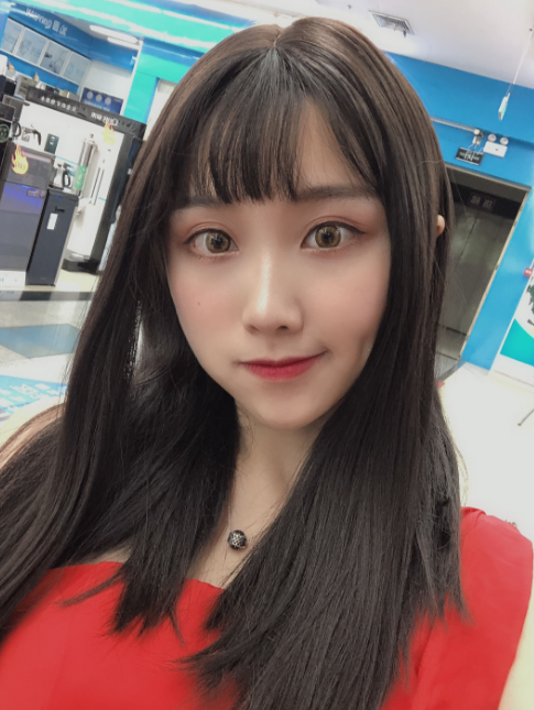 在广州广美找孙恺做的双眼皮,恢复120天了