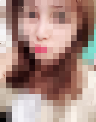 在福州爱美尔做的隆鼻,张胜利医生的做出来的