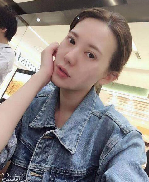 在南昌韩美做的隆鼻和双眼皮,快四个月了