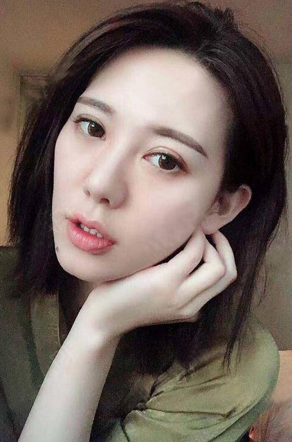 在南昌韩美做的隆鼻和双眼皮,快四个月了