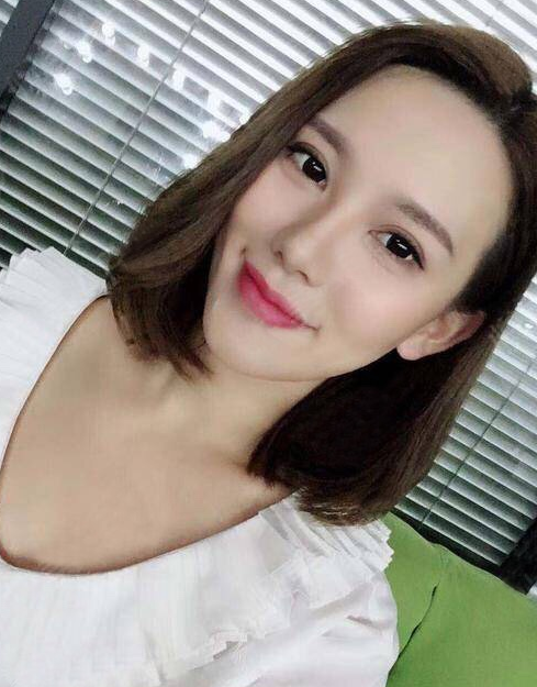 在南昌韩美做的隆鼻和双眼皮,快四个月了