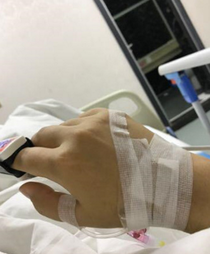 在广州紫馨做的超声波吸脂瘦脸,3个月了