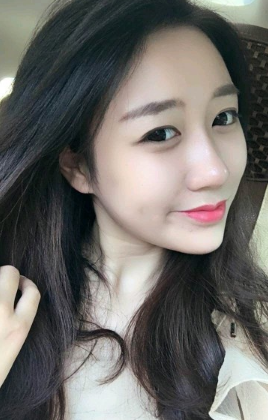 在北京丽星做的隆鼻,*果很好